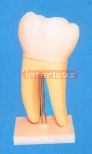 GIANT MOLAR WITH STAND